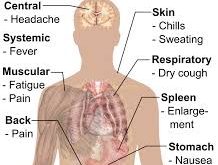 Malaria Symptoms, Causes, Precautions & Treatment (Urdu-English)
