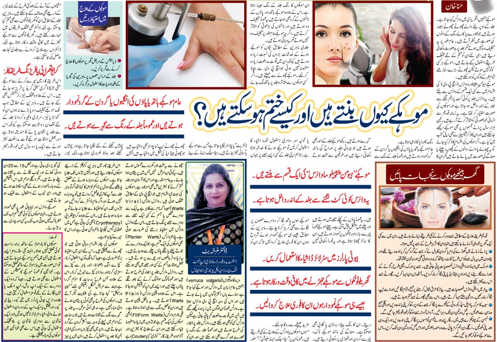 Warts Symptoms, Causes, Precautions & Treatment (Urdu & English)