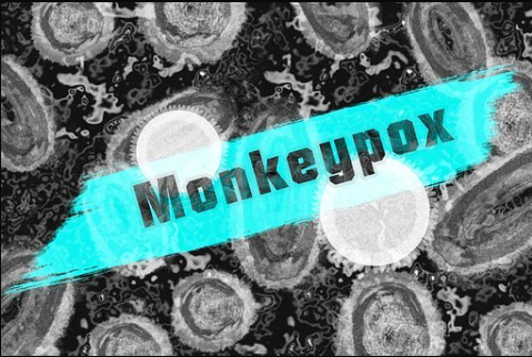 Monkeypox Guide-Signs, Precautions, Diagnosis, Risks, Causes & Homeopathic Treatment